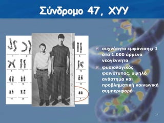 Σύνδρομο 47, ΧΥΥσυχνότητα εμφάνισης: 1 στα 1.000 άρρενα νεογέννηταφυσιολογικός φαινότυπος, υψηλό ανάστημα και προβληματική κοινωνική συμπεριφορά 3737