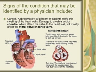 Signs of the condition that may be identified by a physician include: Carditis. Approximately 50 percent of patients show this swelling of the heart walls. Damage to a  valve  and/or  chordae , which attach the valve to the heart wall, will mostly affect the  mitral valve  or  aortic valve . 