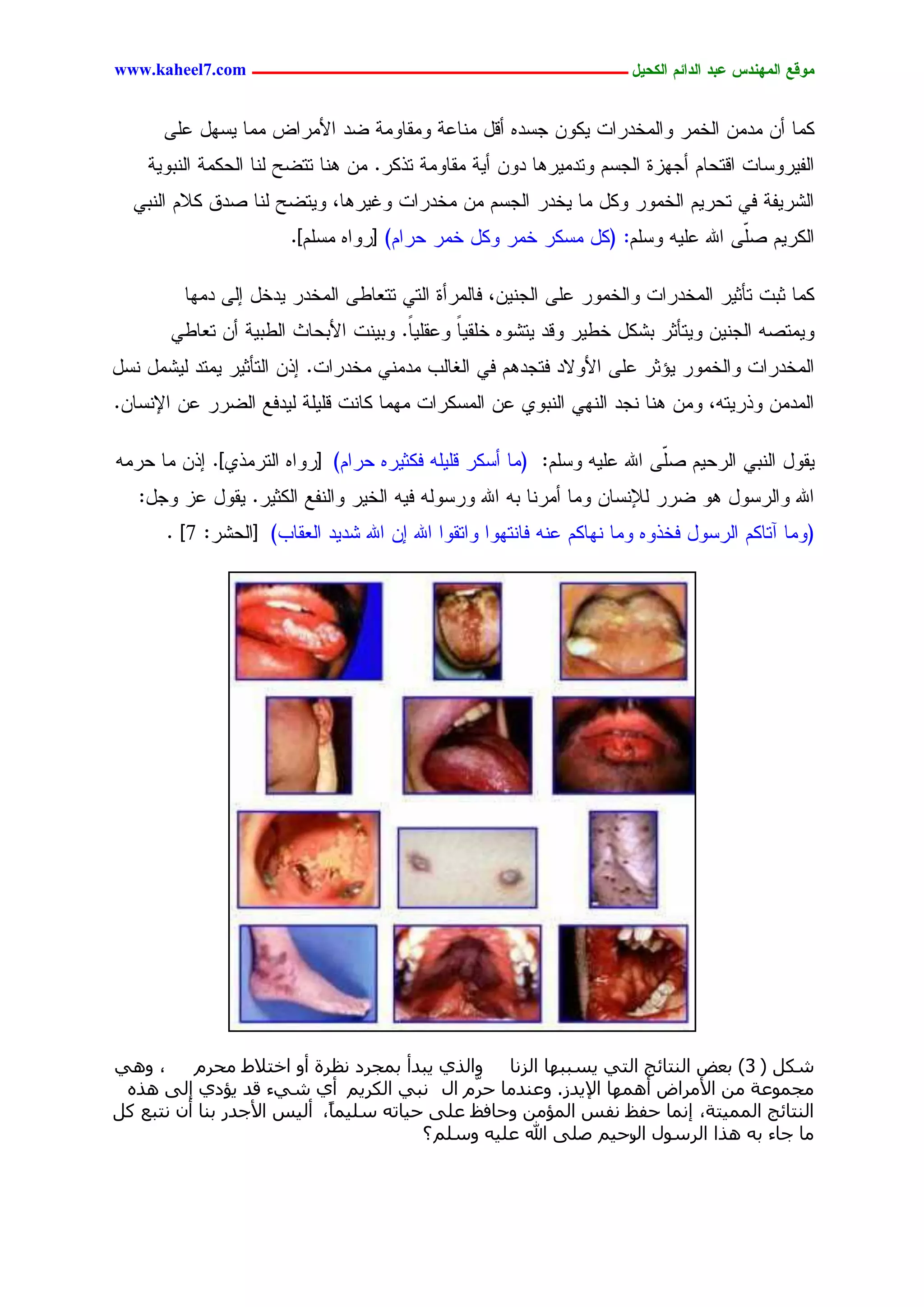 ‫يّكؾ اهيٌِدس ؿتد اهدائى اهندٖل ــــــــــــــــــــــــــــــــــــ ‪www.kaheel7.com‬‬


      ‫ٌِح ؤّ ِدِّ جٍخِر ٗجٍِخدرجز ٌّٜٗ ظشدٓ ؤىل ِْحؿر ِٗيحِٗر غد جألِرجع ِِح ٜشٖل ؿَٙ‬
    ‫جٍهٜرٗشحز جىسػحُ ؤظٖزذ جٍظشُ ٗسدِٜرٕح دّٗ ؤٜر ِيحِٗر سذٌر. ِّ ْٕح سسغغ ٍْح جٍػٌِر جٍْدٜٗر‬
  ‫جٍضرٜهر نٛ سػرُٜ جٍخِٗر ٌٗل ِح ٜخدر جٍظشُ ِّ ِخدرجز ٗكٜرٕح، ٜٗسغغ ٍْح ظدو ٌالُ جٍْدٛ‬
                        ‫جٌٍرُٜ ظّٙ جهلل ؿَٜٔ ٗشَُ: (ٌل ِشٌر خِر ٌٗل خِر ػرجُ) [رٗجٓ ِشَُ].‬
                                                                                 ‫َ‬

         ‫ٌِح صدز سإصٜر جٍِخدرجز ٗجٍخِٗر ؿَٙ جٍظّْٜ، نحٍِرؤذ جٍسٛ سسـحػٙ جٍِخدر ٜدخل اٍٙ دِٖح‬
       ‫ِٜٗسظٔ جٍظّْٜ ٜٗسإصر دضٌل خػٜر ٗىد ٜسضٗٓ خَيٜح ٗؿيًَٜ. ٗدْٜز جألدػحش جٍػدٜر ؤّ سـحػٛ‬
                                      ‫ح‬      ‫ً‬
‫جٍِخدرجز ٗجٍخِٗر ٜئصر ؿَٙ جألٗالد نسظدُٕ نٛ جٍلحٍخ ِدِْٛ ِخدرجز. اذّ جٍسإصٜر ِٜسد ٍٜضِل ْشل‬
‫جٍِدِّ ٗذرٜسٔ، ِّٗ ْٕح ْظد جٍْٖٛ جٍْدٗٚ ؿّ جٍِشٌرجز ِِٖح ٌحْز ىََٜر ٍٜدنؾ جٍغرر ؿّ جإلْشحّ.‬

‫ٜيٗل جٍْدٛ جٍرػُٜ ظّٙ جهلل ؿَٜٔ ٗشَُ: (ِح ؤشٌر ىََٜٔ نٌصٜرٓ ػرجُ) [رٗجٓ جٍسرِذٚ]. اذّ ِح ػرِٔ‬
                                                                         ‫َ‬
   ‫جهلل ٗجٍرشٗل ٕٗ غرر ٍإلْشحّ ِٗح ؤِرْح دٔ جهلل ٗرشٍٗٔ نٜٔ جٍخٜر ٗجٍْهؾ جٌٍصٜر. ٜيٗل ؿز ٗظل:‬
       ‫(ِٗح آسحٌُ جٍرشٗل نخذٗٓ ِٗح ْٖحٌُ ؿْٔ نحْسٖٗج ٗجسيٗج جهلل اّ جهلل ضدٜد جٍـيحخ) [جٍػضر: 7] .‬




‫، ٝٛ٢‬     ‫شٌَ ( 3) ثؼغ اُ٘زبئظ اُز٢ ٣غججٜب اُضٗب ٝاُز١ ٣جذأ ثٔغشد ٗظشح أٝ اخزالؽ ٓحشّ‬
 ‫ٓغٔٞػخ ٖٓ األٓشاع أٜٛٔب اإل٣ذص. ٝػ٘ذٓب حشّّ اٍ ٗج٢ اٌُش٣ْ أ١ ش٢ء هذ ٣إد١ ئُ٠ ٛزٙ‬
‫اُ٘زبئظ أُٔ٤زخ، ئٗٔب حلع ٗلظ أُإٖٓ ٝحبكع ػِ٠ ح٤برٚ عِ٤ٔبً، أُ٤ظ األعذس ث٘ب إٔ ٗزجغ ًَ‬
                                        ‫ٓب عبء ثٚ ٛزا اُشعٍٞ سح٤ْ طِ٠ هللا ػِ٤ٚ ٝعِْ ؟‬
                                                                ‫اٍ‬




                                           ‫95‬
 