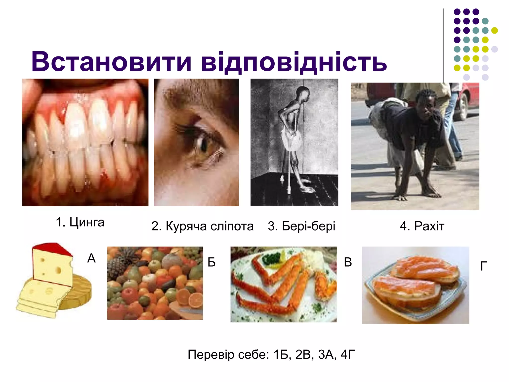 Встановити відповідність 1. Цинга Г 2. Куряча сліпота 3. Бері-бері 4. Рахіт В Б А Перевір себе: 1Б, 2В, 3А, 4Г 