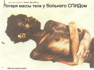 Наблюдаются следующие симптомы: Пятна, сыпь, фурункулы на коже и под кожей Увеличение лимфоузлов Потеря массы тела  у больного СПИДом http://www.deti-66.ru   Портал «Дети-66. ru » «Мастер презентаций». 