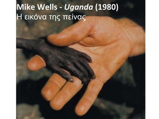 Mike Wells -  Uganda  (1980) Η εικόνα της πείνας 