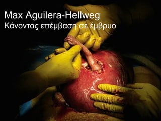 Max Aguilera-Hellweg Κάνοντας επέμβαση σε έμβρυο 