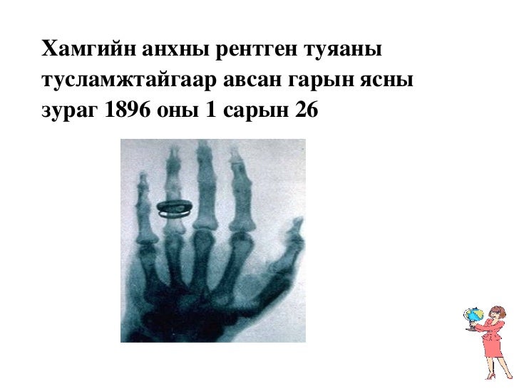 рентген цацраг