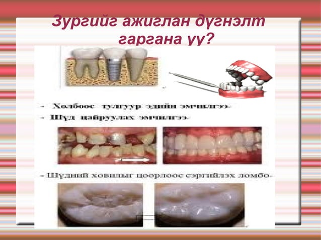 амны хөндий шүд туг