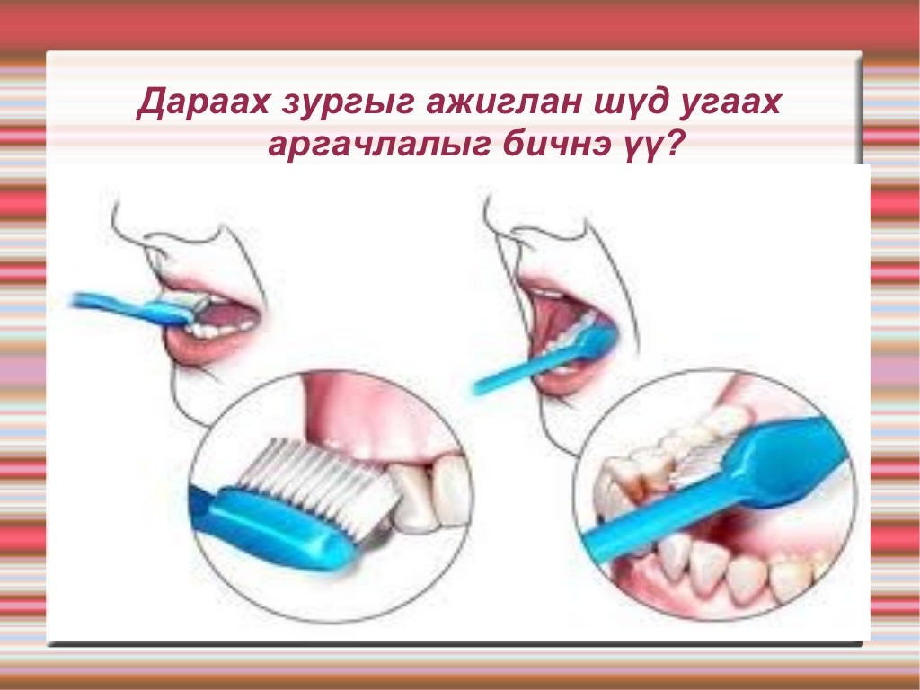 амны хөндий шүд туг