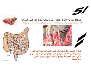 س/5 الإجابة: هل هنالك صلة بين الأمراض التالية و المواد الغذائية المتوفرة في اللحوم الحمراء ؟ أ  ـ سرطان القولون  ب ـ مرض القلب     ج ـ سرطان البروستاتا     د ـ سرطان المعدة   الدهون المشبعة والكولسترول في اللحوم الحمراء ـ خاصة لحم البقر ـ تزيد من احتمال الإصابة بأمراض القلب ، ولكن من غير المؤكد  من أن ما في اللحوم الحمراء قد يوضح ارتباطه الوثيق بسرطان القولون والبروستاتا  . 