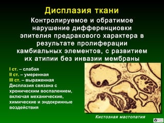 Дисплазия ткани Контролируемое и обратимое нарушение дифференциовки эпителия предракового характера в результате пролиферации камбиальных элементов, с развитием их атипии без инвазии мембраны I  ст.  – слабая II  ст.  – умеренная III  ст.  – выраженная Дисплазия связана с хроническим воспалением, включая механические, химические и эндокринные воздействия Кистозная мастопатия 