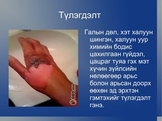тусламж | PPT