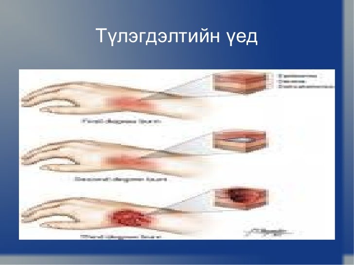 тусламж
