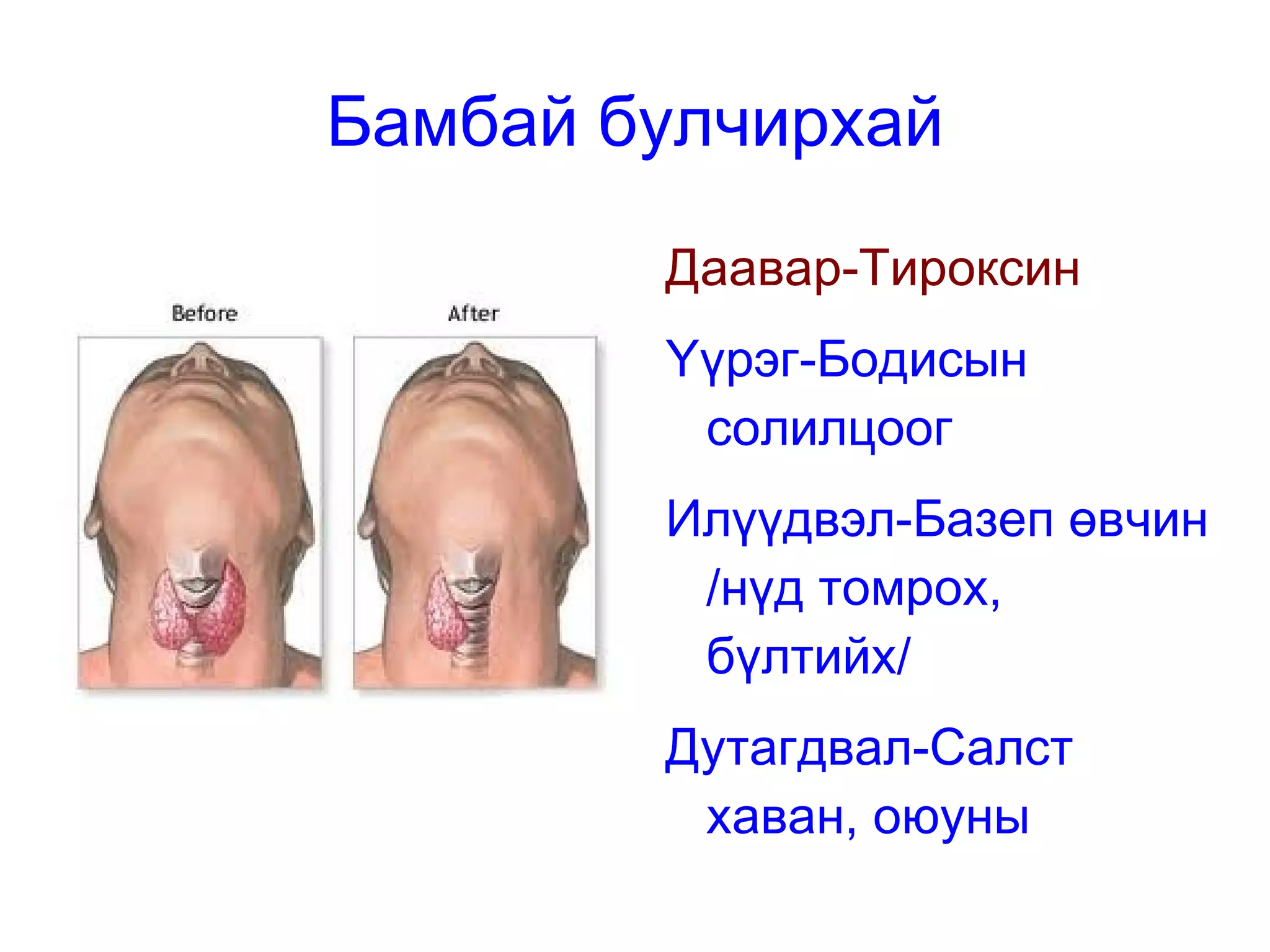 Эд эрхтэний хөндийд нээгддэг 