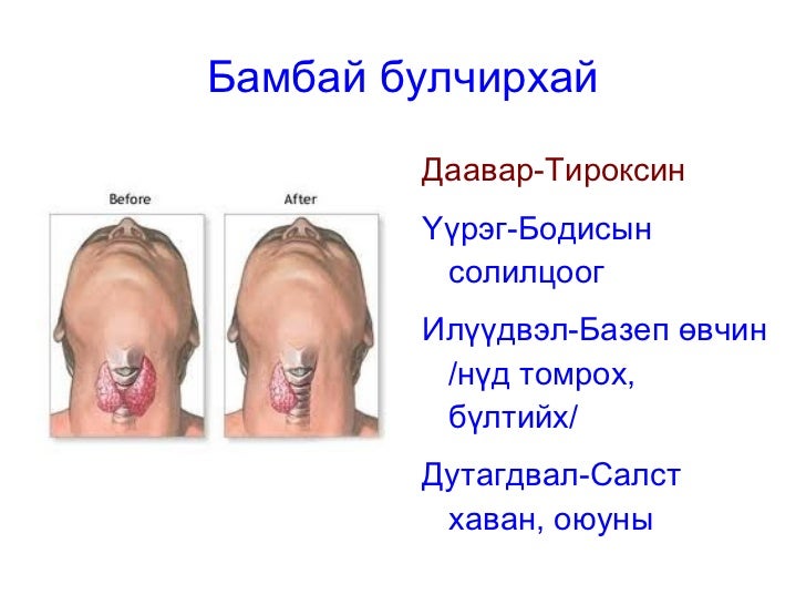 дотоод шүүрлийн булчирхай