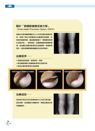 Cover Story

探腦除憂
 新膝望




               關於「膝關節健康促進方案」
               （Knee Health Promotion Option, KHPO）

               根據大林慈濟醫院關節中心十年來的臨床經驗和研
               究，發現了退化性膝關節炎的重要致病機轉，在
               病程的適當時機，藉由關節鏡進行「膝關節軟骨再
               生促進手術」，移除病因，並重塑健康的膝關節環
               境，術後輔以適當的軟骨再生促進療程，刺激軟骨
               再生，進而逆轉膝關節繼續退化的自然病程。
                                                      右       左



               治療程序──
               ＊詳細的術前診斷、病情評估、衛教
               ＊經由關節鏡進行膝關節軟骨再生促進手術
               ＊術後必要的軟骨再生促進療程


          隱藏的病灶──膝關節的內側皺壁          以關節鏡手術清除皺壁的鬚狀組織        組織清除乾淨後的內側皺壁




               治療成效──
               目前每年有近五百位病患接受中心以此方案治療，
               成效卓著，並持續進行相關研究，預期治療成功率
               可繼續提升。




 24
人醫心傳
2010年6月
 