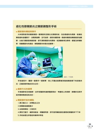 腦瘤治療在花蓮
                                  退化性膝關節炎之治療新觀念




退化性膝關節炎之關節鏡整形手術
●   關節鏡的構造與操作
    大林慈院使用的關節鏡是一套精密的全數位光學鏡系統，包含微細的內視鏡，就像鉛
筆般細的金屬管子，含電視螢幕，及可拍照、錄影的攝影機。微細的關節結構都能詳加觀
察，以進行關節腔病變診斷，更可清除關節內的異物、或游離軟骨及骨刺，磨整及修補軟
骨，剝離關節內的連結，解鬆關節內的發炎組織等。




                               攝影／于劍興

    手術過程中，醫師一邊操作一邊解釋，病人可藉由螢幕看到整個關節鏡下的診斷狀
況，正確診斷率幾近百分之百。


●   麻醉方式的選擇
    半身麻醉或全身麻醉，由手術醫師和麻醉醫師商討，考量病人的意願、身體狀況與手
術所需時間長短而決定。


●   關節鏡手術的優點
    1.開刀傷口小，約零點五公分
    2.對關節組織傷害少
    3.住院時間短；三到四天
    4.開完刀當天，麻醉消退後，得醫師同意，即可使用輔助器在護理或家屬陪伴下下床
    5.手術後發生併發症的機率非常低




                                                   25
                                              人醫心傳
                                                  2010年6月
 