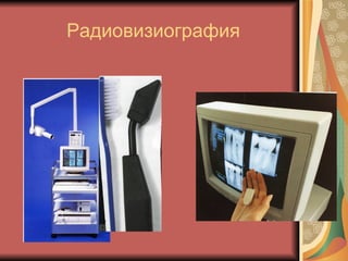 Радиовизиография 
