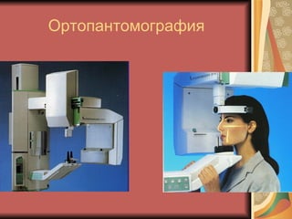 Ортопантомография 
