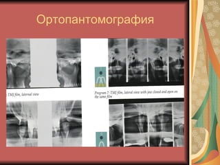Ортопантомография 