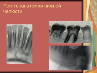 Рентгенанатомия нижней челюсти 