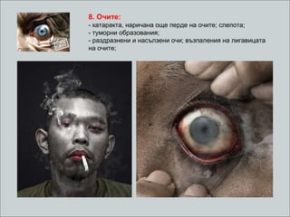 8.  Очите : - катаракта, наричана още перде на очите; слепота; - туморни образования;  -  раздразнени и насълзени очи ; в ъзпаления на лигавицата на очите ; 