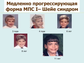 Медленно прогрессирующая форма МПС  І – Шейе синдром Medical training document for internal use only 3 года 4 года 6 лет 8 лет 11 лет 