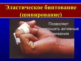 Эластическое бинтование (шинирование) Позволяет  совершать активные движения 
