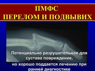 ПМФС  ПЕРЕЛОМ И ПОДВЫВИХ Потенциально разрушительное для сустава   повреждение, но хорошо поддается лечению при ранней диагностике 