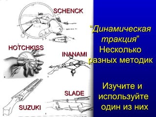 “ Динамическая тракция ” Несколько разных методик SCHENCK HOTCHKISS Изучите и  используйте один из них INANAMI SLADE SUZUKI 