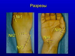 Разрезы № 1 № 2 № 3 № 4 № 5 