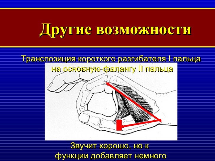 Лады ограниченной транспозиции