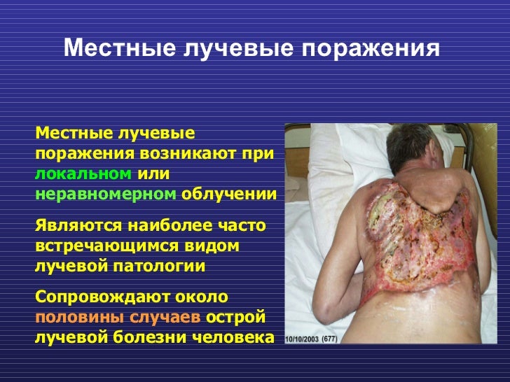 Заболевание организма человека реферат 8948