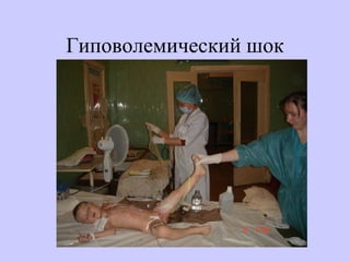 Гиповолемический шок 