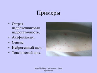 Примеры Острая надпочечниковая недостаточность,  Анафилаксия,  Сепсис,  Нейрогенный шок,  Токсический шок.  MeduMed.Org -  Медицина - Наше Призвание 
