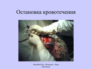Остановка кровотечения MeduMed.Org -  Медицина - Наше Призвание 