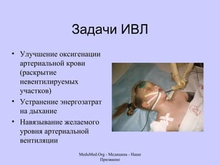 Задачи ИВЛ Улучшение оксигенации артериальной крови (раскрытие невентилируемых участков) Устранение энергозатрат на дыхание Навязывание желаемого уровня артериальной вентиляции MeduMed.Org -  Медицина - Наше Призвание 