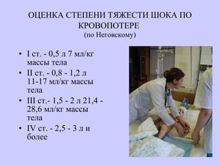 ОЦЕНКА СТЕПЕНИ ТЯЖЕСТИ ШОКА ПО КРОВОПОТЕРЕ   (по Неговскому) I ст. - 0,5 л 7 мл/кг массы тела II ст. - 0,8 - 1,2 л 11-17 мл/кг массы тела III ст.- 1,5 - 2 л 21,4 - 28,6 мл/кг массы тела IV ст. - 2,5 - 3 л и более 