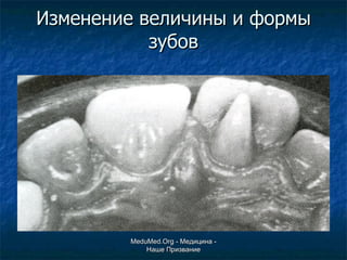 Изменение величины и формы зубов MeduMed.Org -  Медицина - Наше Призвание 