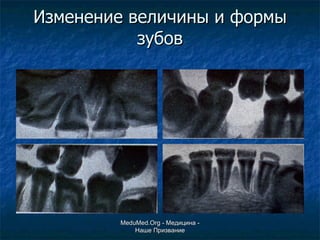 Изменение величины и формы зубов MeduMed.Org -  Медицина - Наше Призвание 