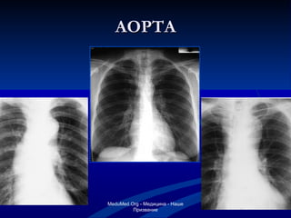 АОРТА MeduMed.Org -  Медицина - Наше Призвание 