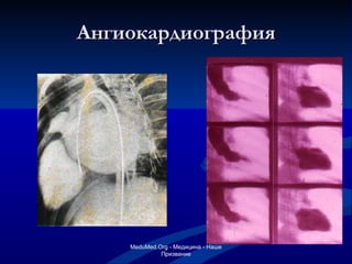 Ангиокардиография MeduMed.Org -  Медицина - Наше Призвание 