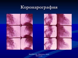 Коронарография MeduMed.Org -  Медицина - Наше Призвание 