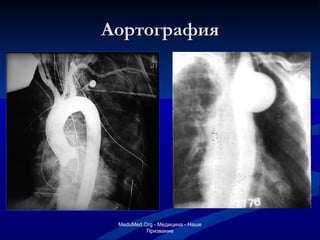 Аортография MeduMed.Org -  Медицина - Наше Призвание 