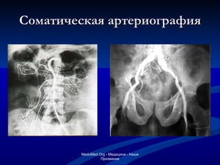 Соматическая артериография MeduMed.Org -  Медицина - Наше Призвание 