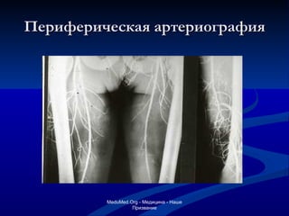 Периферическая артериография MeduMed.Org -  Медицина - Наше Призвание 