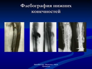 Флебография нижних конечностей MeduMed.Org -  Медицина - Наше Призвание 