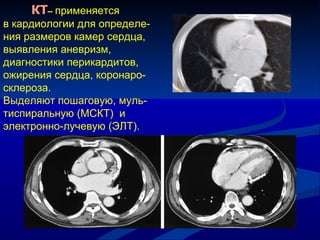 КТ –  применяется  в кардиологии для определе-ния размеров камер сердца, выявления аневризм, диагностики перикардитов, ожирения сердца, коронаро-склероза.  Выделяют пошаговую, муль-тиспиральную  ( МСКТ )  и  электронно-лучевую (ЭЛТ).   