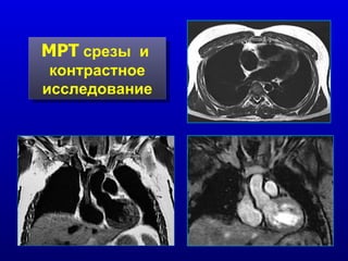 МРТ  срезы  и  контрастное исследование 