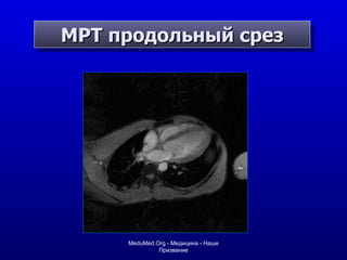 МРТ продольный срез MeduMed.Org -  Медицина - Наше Призвание 