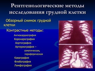 Рентгенологические   методы   исследования грудной клетки Обзорный снимок грудной клетки  Контрастные методы: Ангиокардиография Коронарография Аортография  Артериография – соматическая , периферическая Каваграфия Флебография  Лимфография 