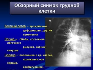 Обзорный снимок грудной клетки Костный остов  –  врождённые деформации, другие изменения Лёгкие   –  объём, состояние лёгочного рисунка, корней, синусов Сердце  –  положение в гр. клетке,  положение оси сердца, конфигурация, размеры, наличие кальцификатов Аорта  -  положение, размеры, наличие кальцификатов 
