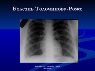 Болезнь Толочинова-Роже MeduMed.Org -  Медицина - Наше Призвание 